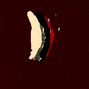 MRI